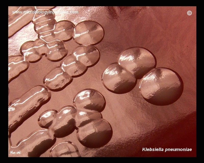 colonies of Klebsiella pneumoniae